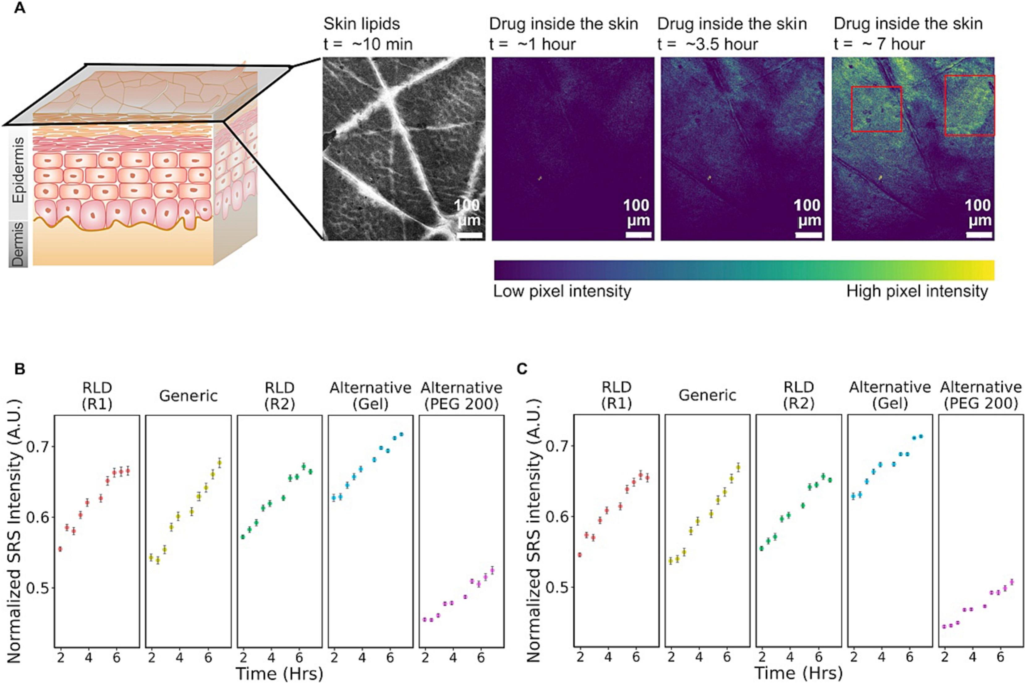 Schematic of skin layers with drug penetration shown via fluorescence imaging (10 min–7 hrs). Graphs compare SRS intensity over time (2–6 hrs) for various drug formulations, showing steady increases with differences by formulation.