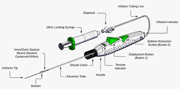 MYNX CONTROL Venous Vascular Closure Device with labeled components.