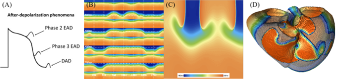 (Figure 3) (A) Schematic comparing Phase 2 and Phase 3 EADs with DADs, (B)  Numerical simulation of discordant alternans caused by EADs in heterogeneous one-dimensional (1D) tissue, (C) Reentry in two-dim