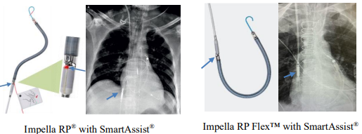 Reference for location of optical sensor in Impella devices for both the Impella RP with SmartAssist and the Impella RP Flex with SmartAssist.