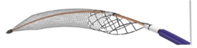 ClotTriever XL Catheter