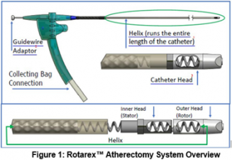 Figure 1 - Rotarex Atherectomy System