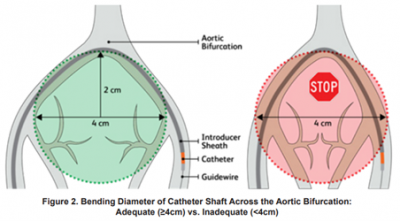 Figure 2 - Bending diameter of catheter shaft