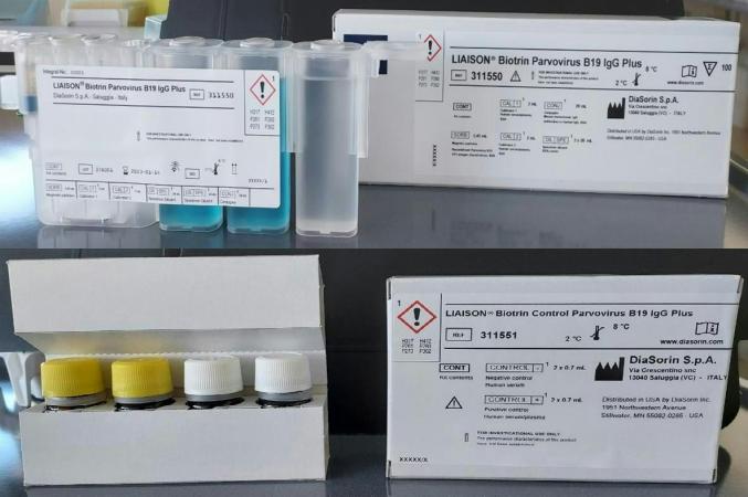 LIAISON Biotrin Parvovirus B19 IgG Plus is a lab test used to detect parvovirus B19 antibody. Control Parvovirus B19 IgG Plus is used as a quality control test.