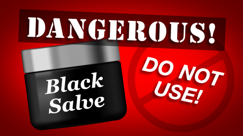 Do Not Use Black Salve Is Dangerous And Called By Many Names Fda