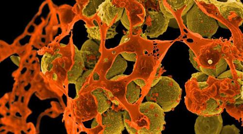 Scanning electron micrograph of methicillin-resistant Staphylococcus aureus (MRSA) surrounded by cellular debris. MRSA resists treatment with many antibiotics. Credit: NIAID