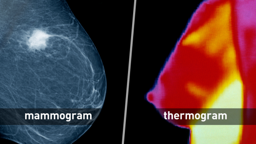 Perfect Breasts: Science Claims to Find Them